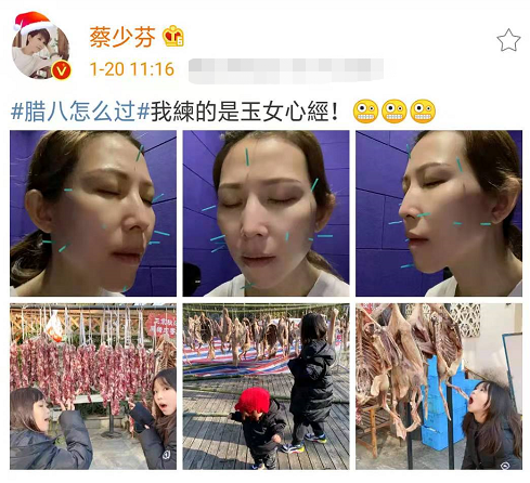 張晉蔡少芬臘八節做針灸，娘娘為保凍顏滿臉扎針，三個兒女齊出鏡