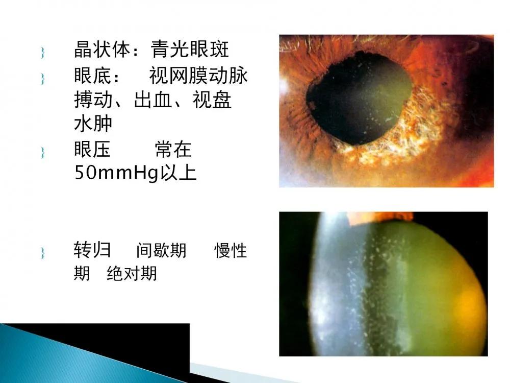 健康科普大赛获奖作品展示⑤|老年人常见眼部不适