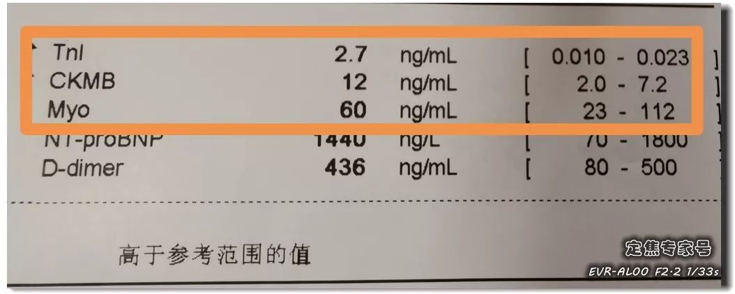 从"上火"到心肌死亡仅5天！速效救心丸和硝酸甘油，谁才是救命药