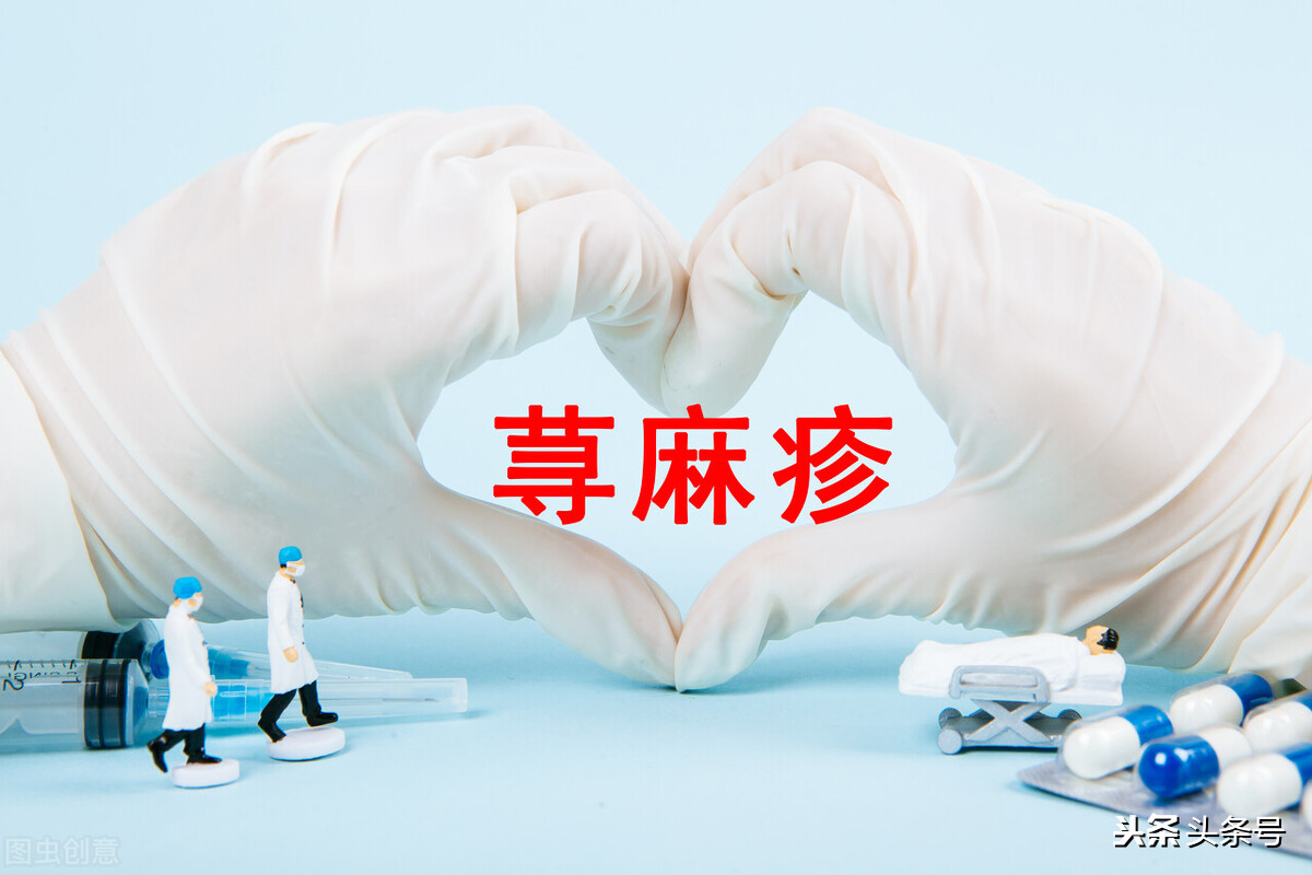 夏秋换季荨麻疹易发，11种用药方法学起来