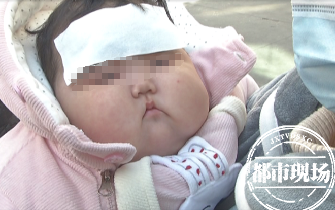 南昌5月龄宝宝体重飙升至20斤，宝妈怀疑面霜有问题：脸越来越大
