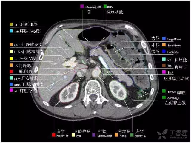 掌握这篇解剖，晋级腹部CT影像诊断高手（精细版）