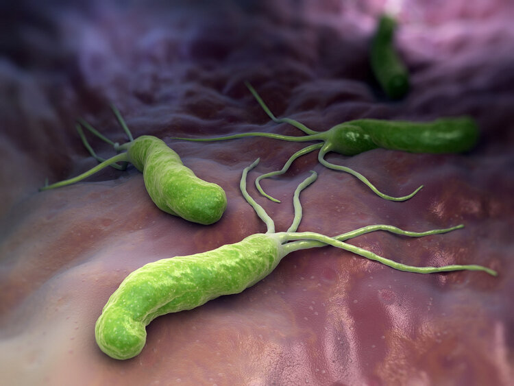 幽门螺杆菌：感染8亿中国人的一级致癌物，到底有多厉害？