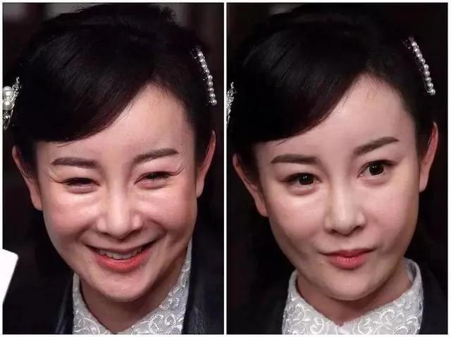 《美人心計》播出11年，10位美人拉開差距，戲外整容遭“毀容”