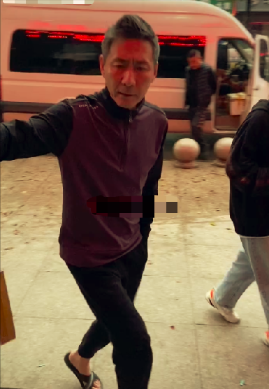 “元芳”张子健近况曝光，身型暴瘦满头白发，受伤坐轮椅跷二郎腿-第11张图片-大千世界