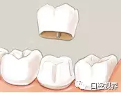 牙隐裂知多少？