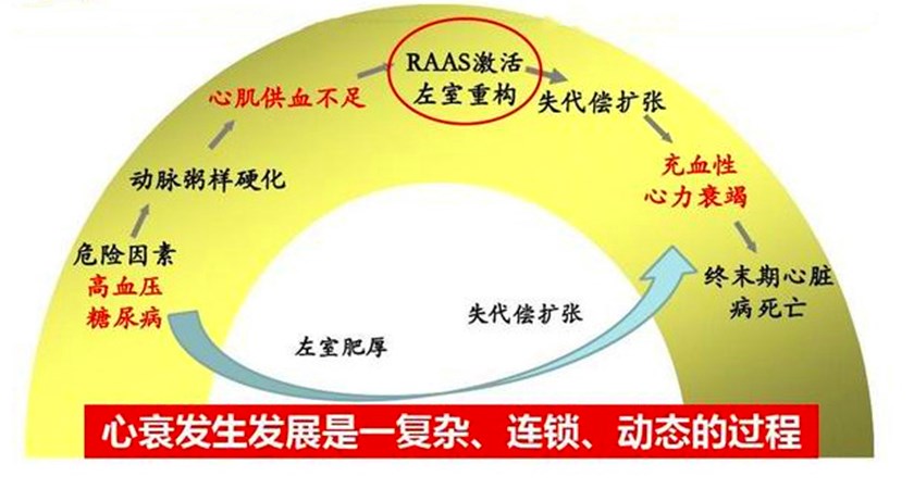 心肌梗死后，为什么有些人的心脏会长出“室壁瘤”？