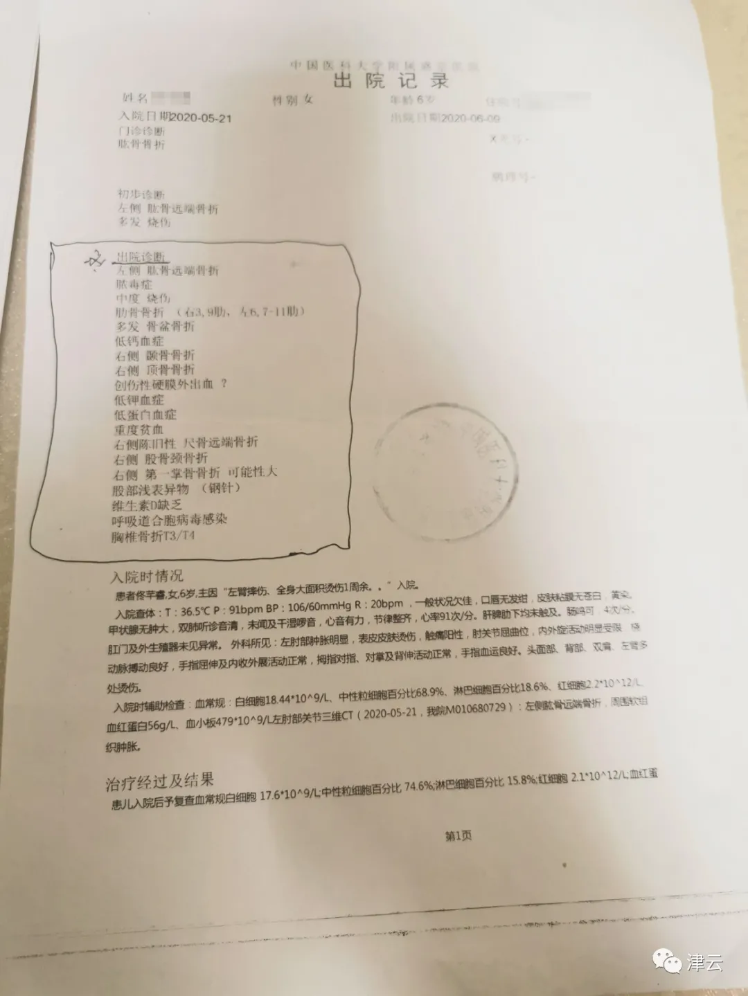开水浇头、烟头烫疤、钳子拔牙……遭亲妈男友虐待,6岁女童伤情鉴定出炉