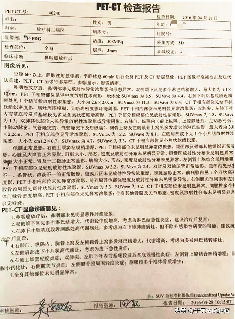 鼻咽癌肺转移患者，接受缓释库超微创治疗后好转