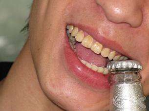 问世间谁的牙齿最牛逼？盘点动物界的那些奇异的牙齿