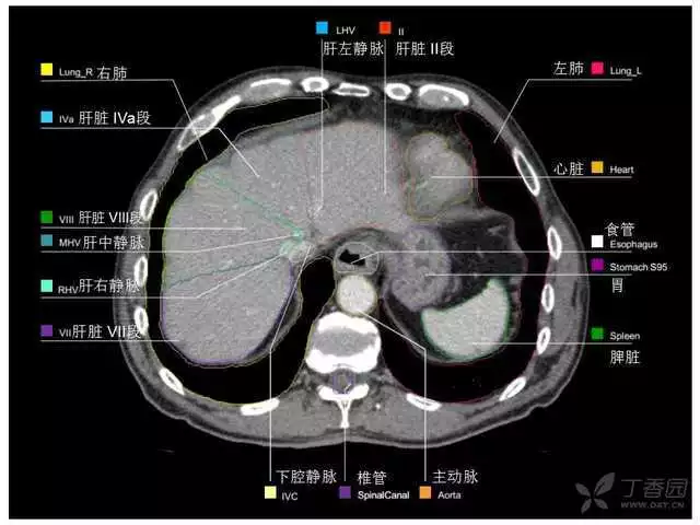 掌握这篇解剖，晋级腹部CT影像诊断高手（精细版）