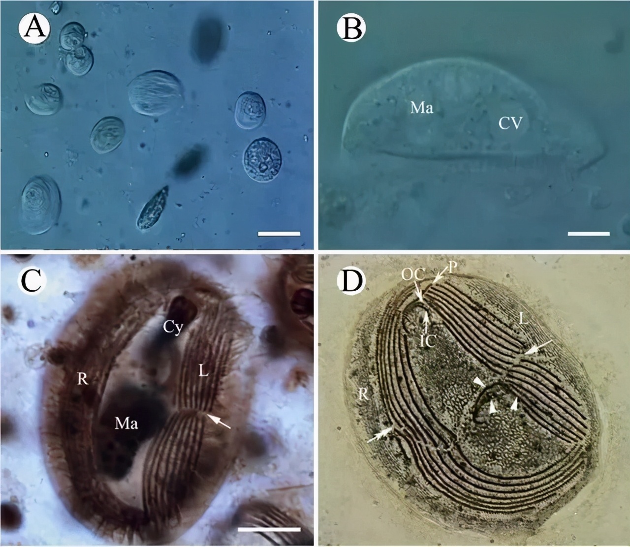 4,杯体虫:鳃丝压片镜检即可确诊;5,指环虫:鱼体分泌大量黏液,鳃瓣浮肿