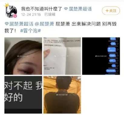 It is 90 flowers together, "Body is cold female advocate " Li Yitong, do not have Yang Zi after all the sort of " flourishing husband " constitution