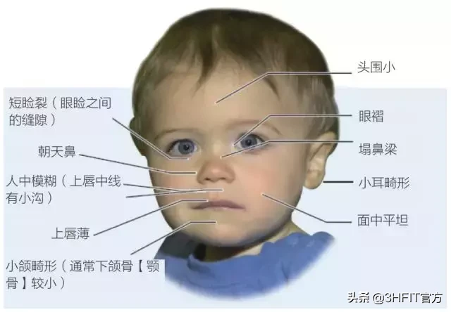 饮酒到底对健康有多大影响?(上)