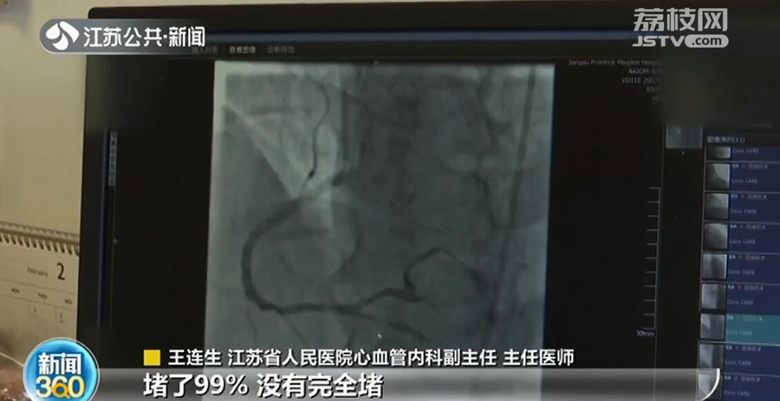 血管堵了99%，患者却从医院偷偷溜回家！幸好医院及时劝回