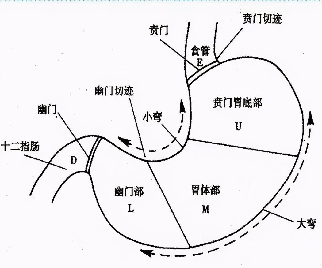 胃输入袢和输出袢图解图片