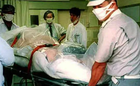 死法最痛苦的日本人：遭核辐射后想安乐死，却