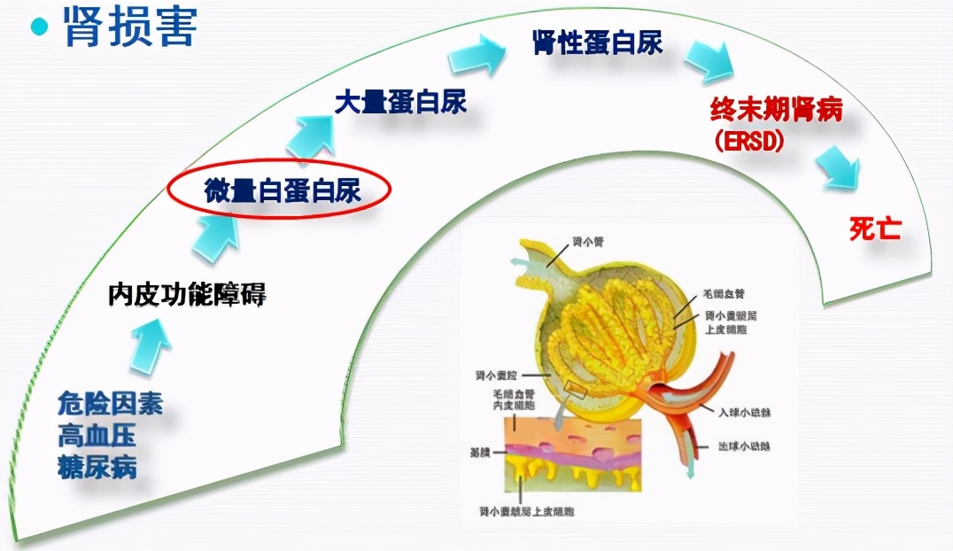 高血压3年没治就造成了心肾损害？发现高血压都该查些什么？