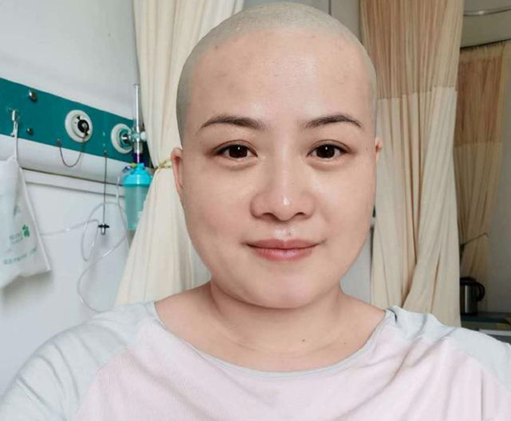 岳云鹏老婆自曝需手术，"秃头"造型令人