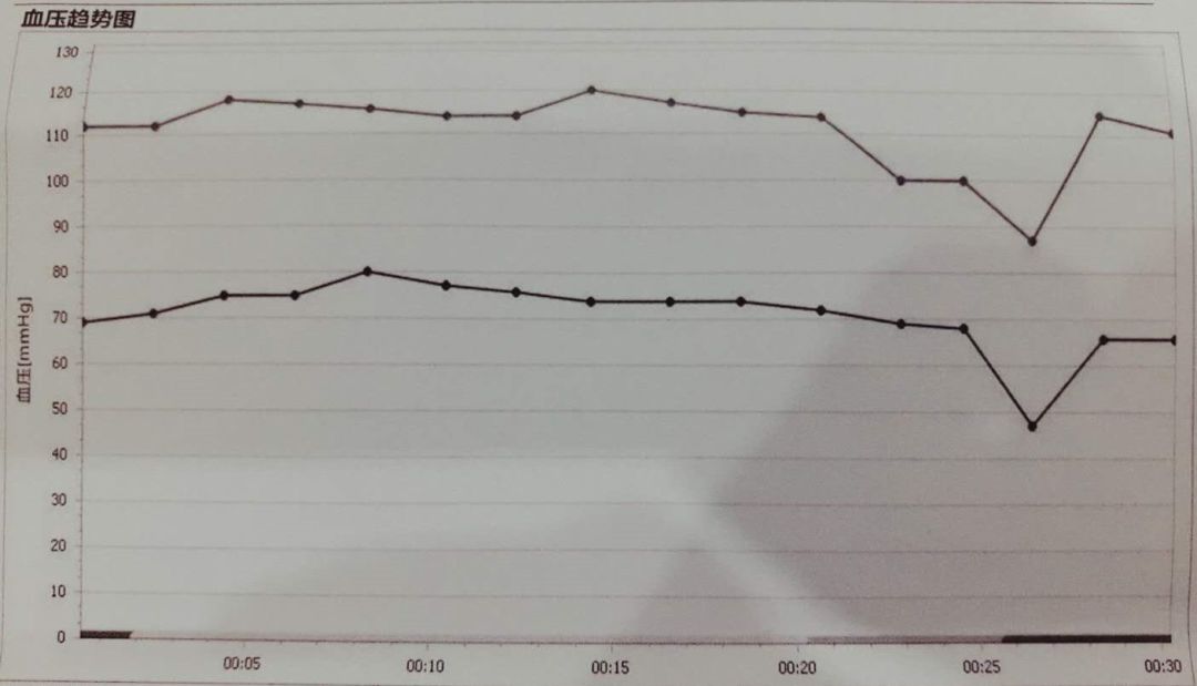 突发晕厥如何处理？这份诊治攻略不可错过