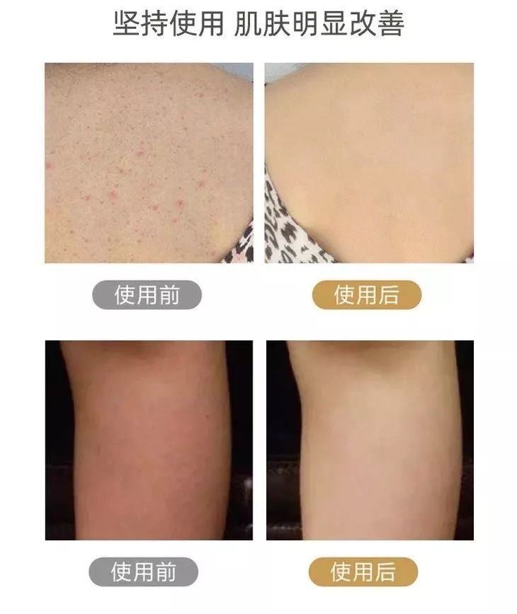 这款“搓澡神器”用了就再也离不开！比毛巾好用百倍！一刷就干净