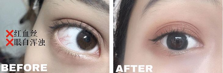 改良自《本草纲目》的护眼良方，眼睛疲惫一贴