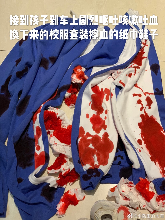 广州一小学生疑遭体罚致哮喘发作，区教育局介