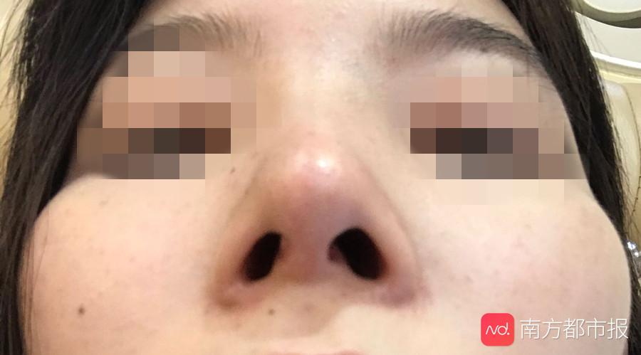 医美整容乱象调查：广告里的“公立整形医院”，竟是失信民营机构