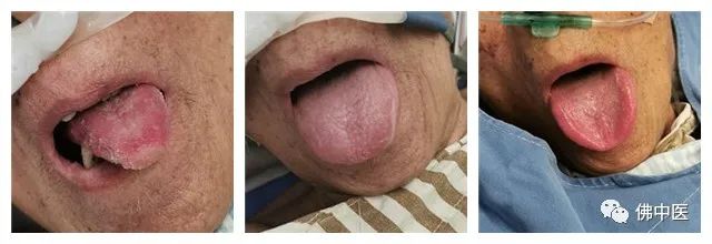 【医师节】肖秋生：让中医药在重症救治中发挥奇效