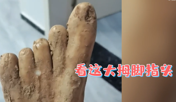 女子买到山药像极了人脚，“指甲盖”清晰可见，网友：成精了