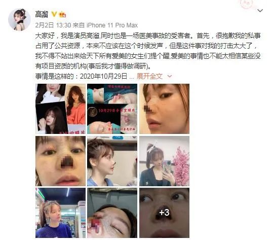 Actress claims nose needle of cure beauty failure is necrotic, how is the person that loves the United States balanced " cure " and " beautiful " ? 