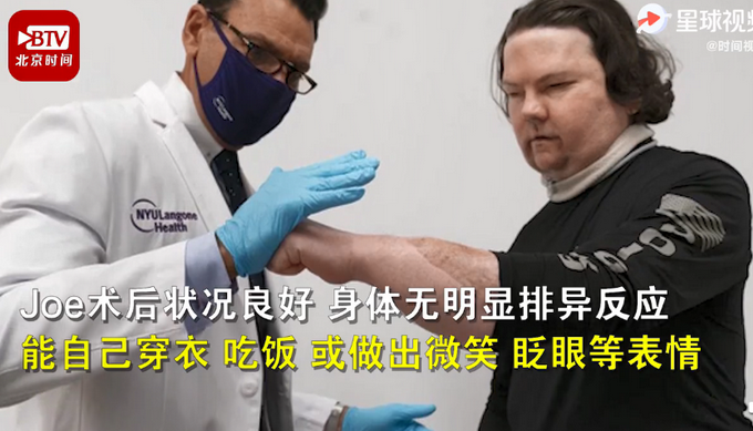 成功|全球首例成功换脸换手手术 目前该患者恢复不错