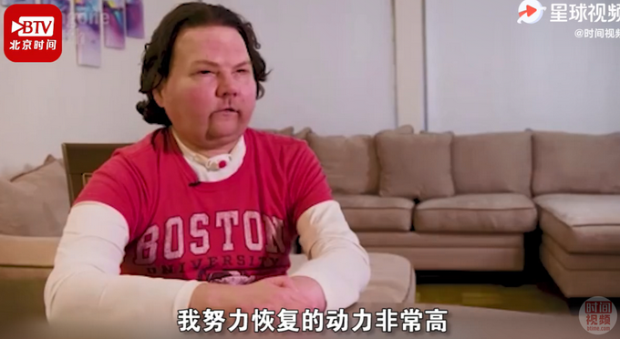 成功|全球首例成功换脸换手手术 目前该患者恢复不错