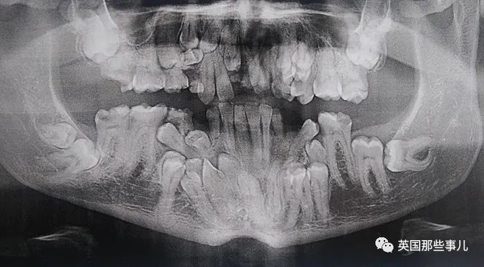 石棺裏藏貓貓，畫下還有另一副畫…X光下的各種物體原來這麽奇妙