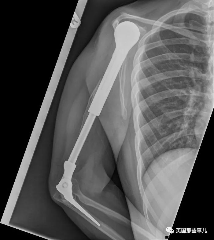 石棺裏藏貓貓，畫下還有另一副畫…X光下的各種物體原來這麽奇妙