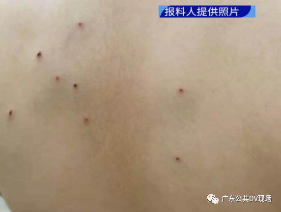 广州一小学生被同学用铅笔戳20多处伤口，家长群“炸锅”，校方回应