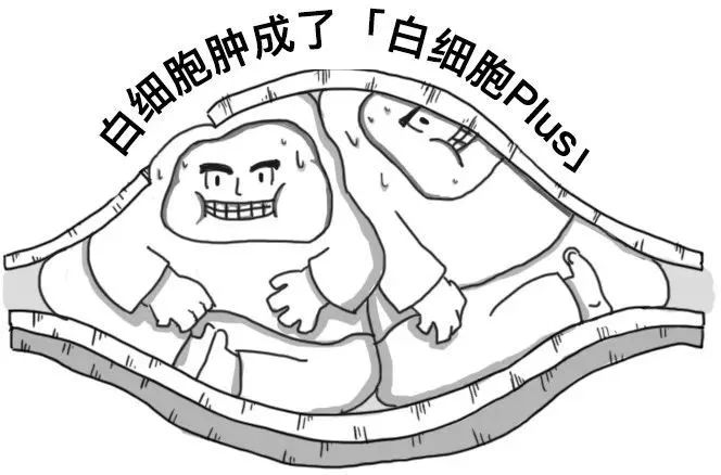 你的血管，就是這樣堵的