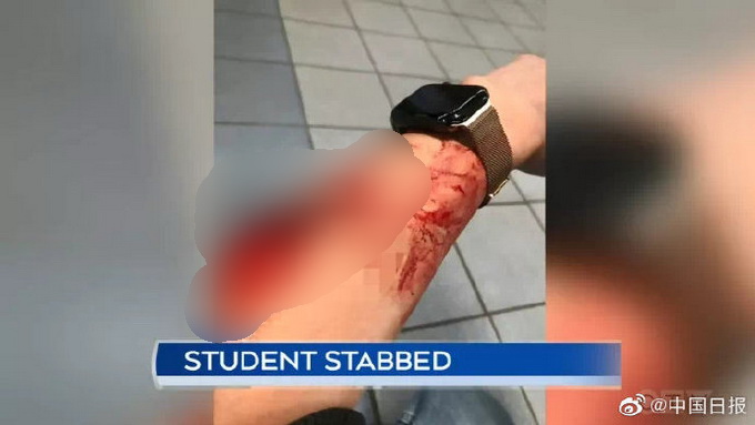 加拿大中国留学生地铁站遭持刀袭击，路人冷眼旁观不报警！中领馆提醒