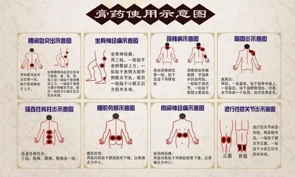 膏药不是你想贴，想贴就能贴