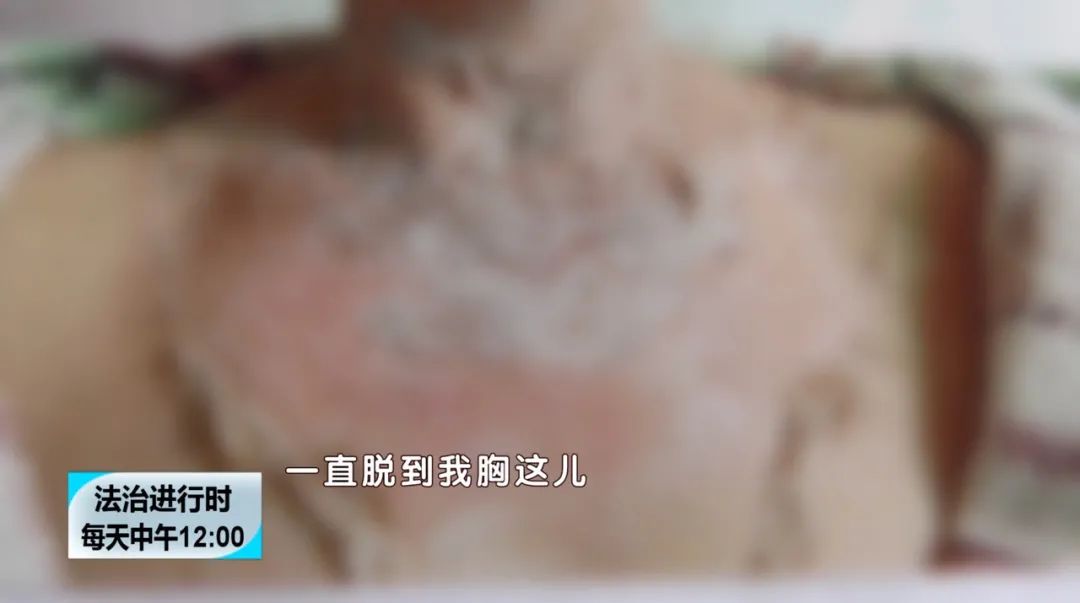 北京奇案：女子使用洗手液后竟然感到“生不如死”，法院做出判决-第2张图片-大千世界