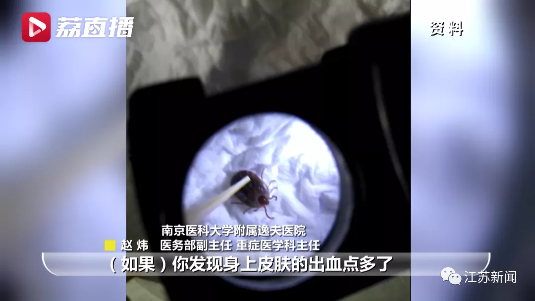 男子钓鱼回家后全身脏器出血，竟感染了这种新型致命病毒