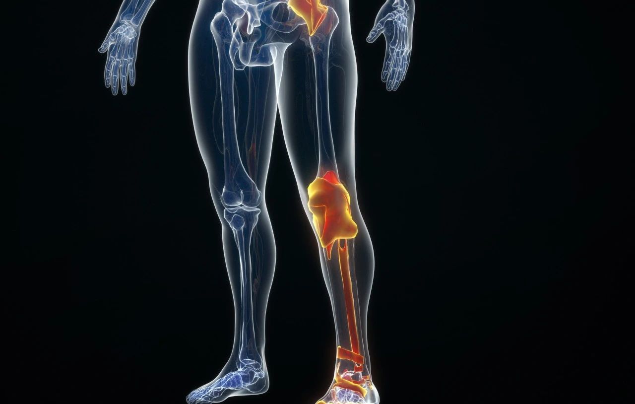 手腕疼痛，活动受限，6种方法应对“节后腱鞘炎” - 知乎