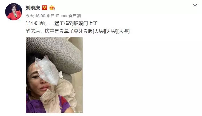 整容后的十大女星，有人吓跑观众，有人成网红，最后一个让人惋惜
