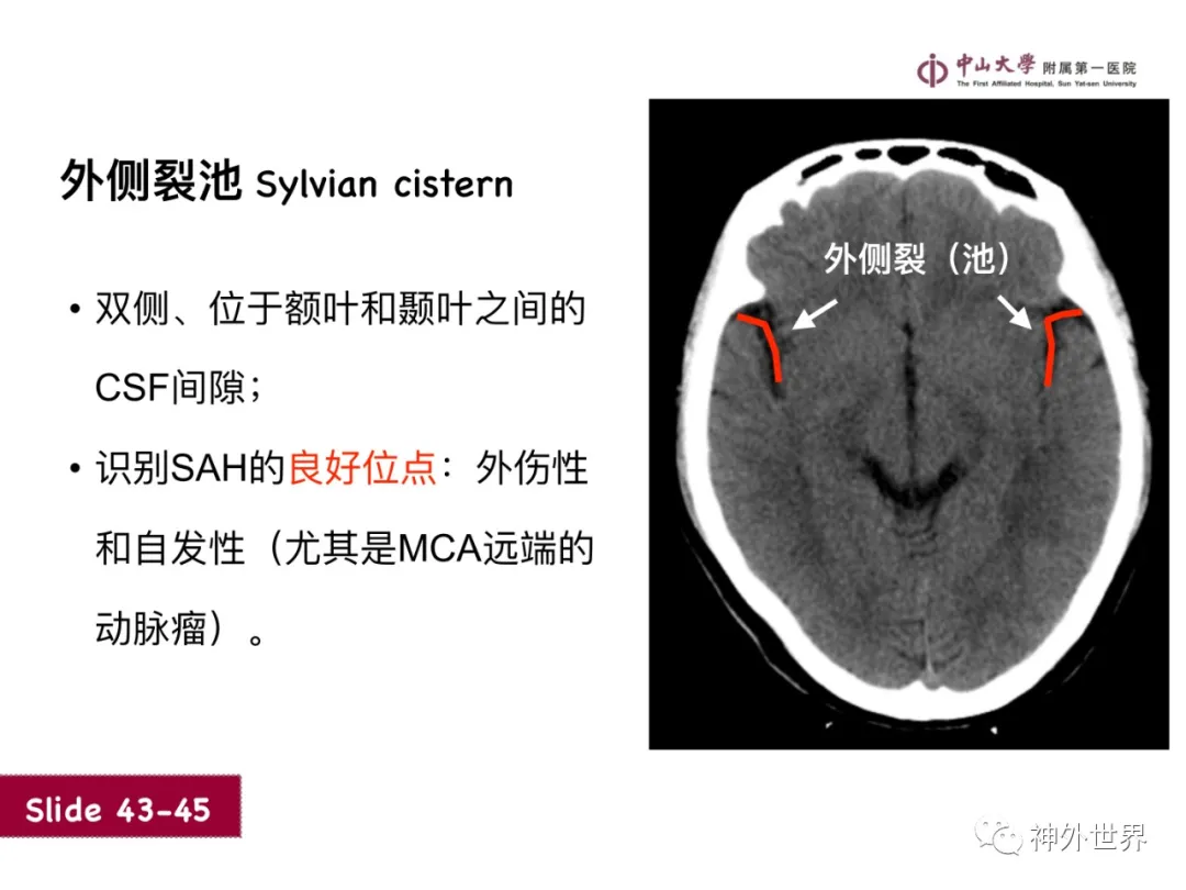 最全影像总结 | 颅内病变 MR、CT 的阅片技巧，太赞了