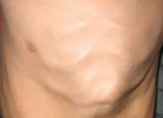 维生素D3的正确用法用量及其在人体中发挥的重要作用