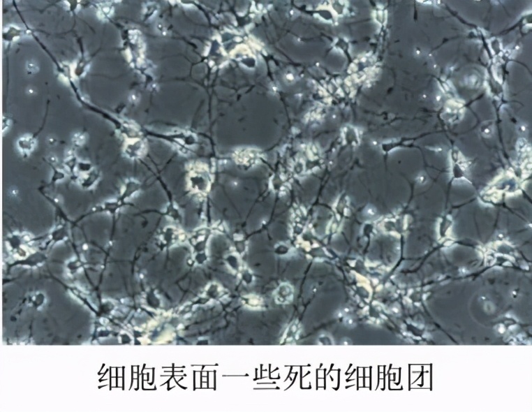 為什么細(xì)胞養(yǎng)不好？你知道哪些養(yǎng)細(xì)胞的技巧？
