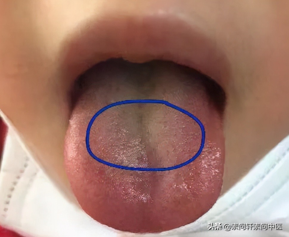 最近小儿感冒特别多？试试这个中西医小儿感冒药里的爱马仕