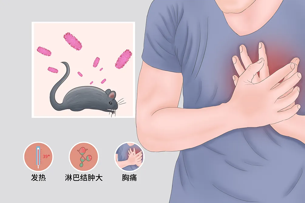 “黑死病”再次来袭?病死率高达30%的鼠疫该如何预防