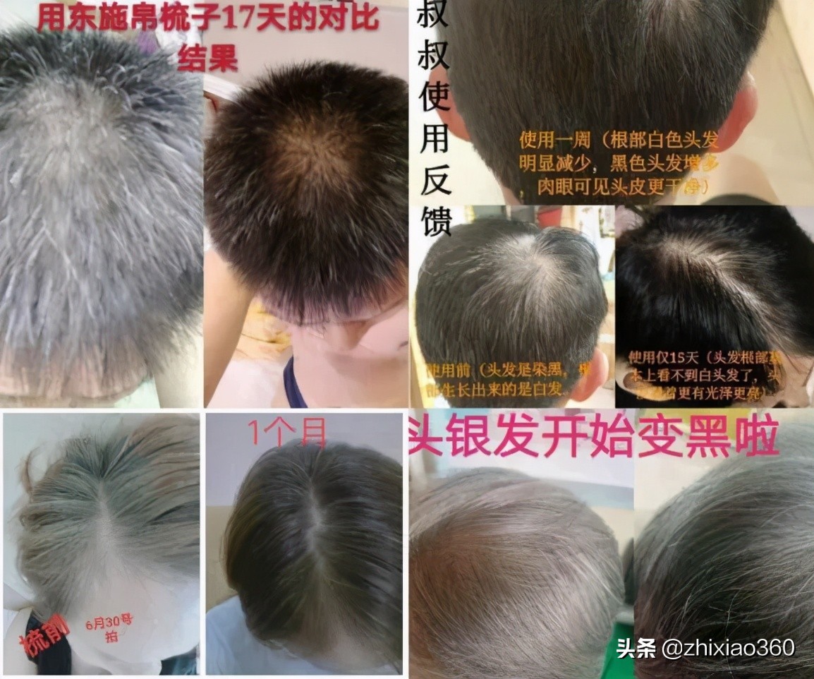 一把梳子能包治百病?涉嫌传销,东施帛关联公司被冻结资金2500万