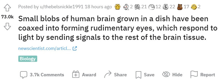 细思极恐！科学家用培养皿制作出人类大脑，还让它长出"眼睛"？